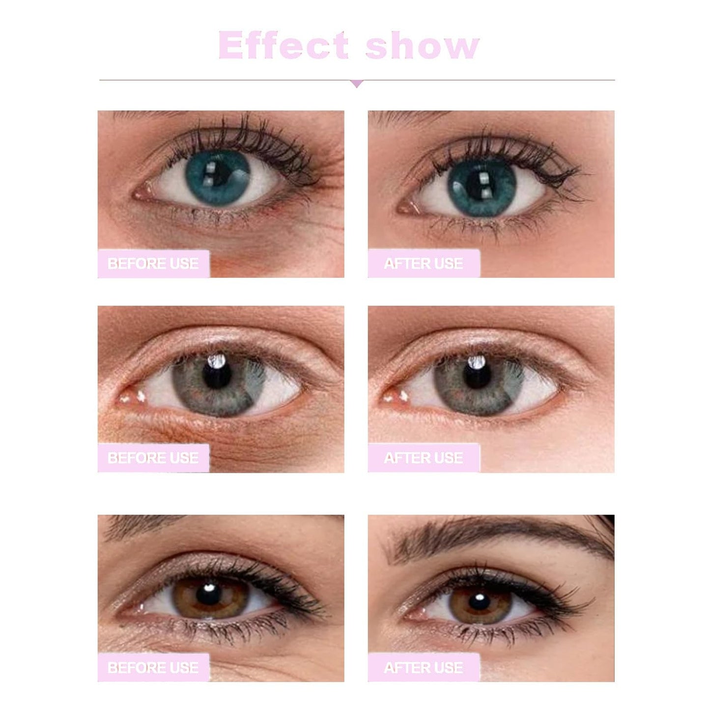 ShengQiu Lutein Eye Essence Oil, VC Rollerball Eye Serum,Anti Aging E/ye Cream for Dark Circles,Wrinkles & Puffiness,Vitamin C E/ye Seru/m for Men and Women, Ey/e Bags Remover,Anti Wrinkle Under Ey/e Cream