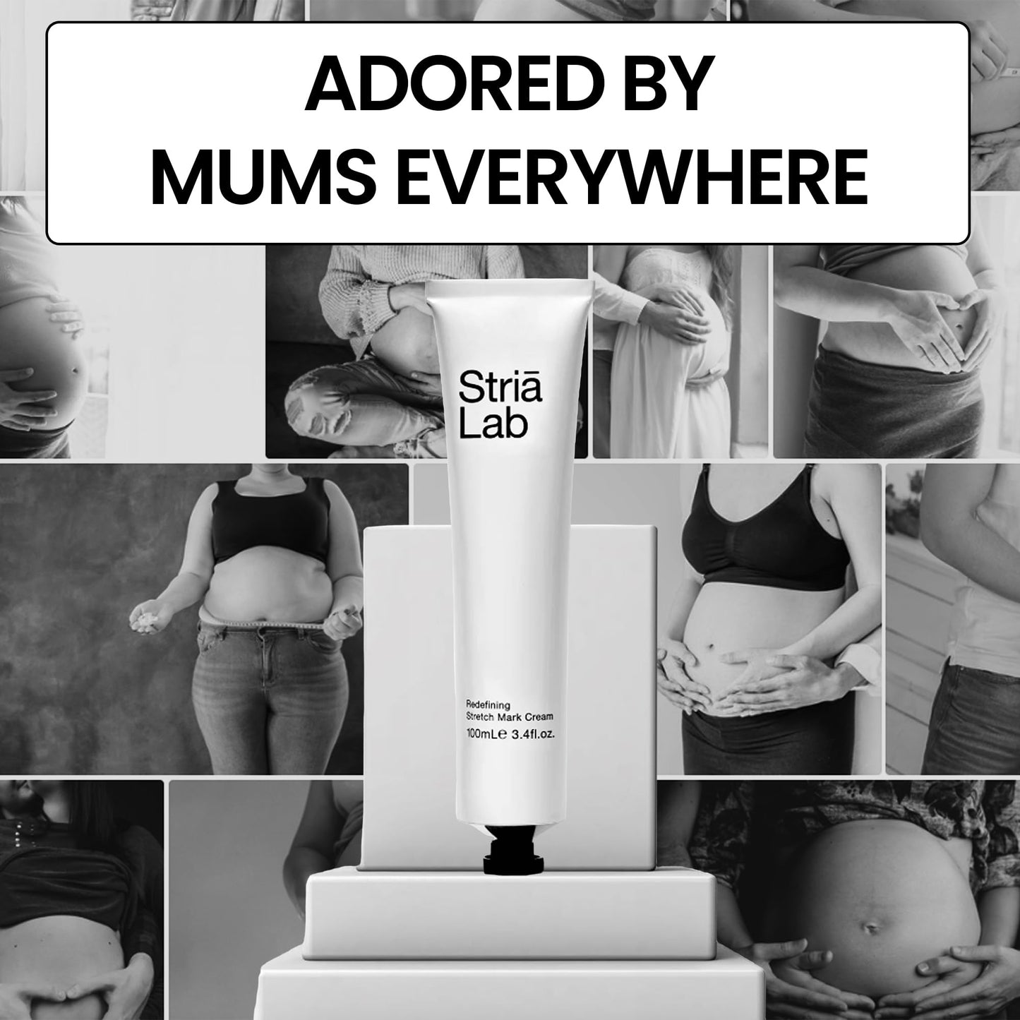 Stria Lab Stretch Marks Removal Cream for Women & Men, 12 Week Cycle – Peptide and Vitamins Stretch Mark & Scar Cream for Reduction in Stretch Marks, Improves Elasticity and Firmness. Award Winning.