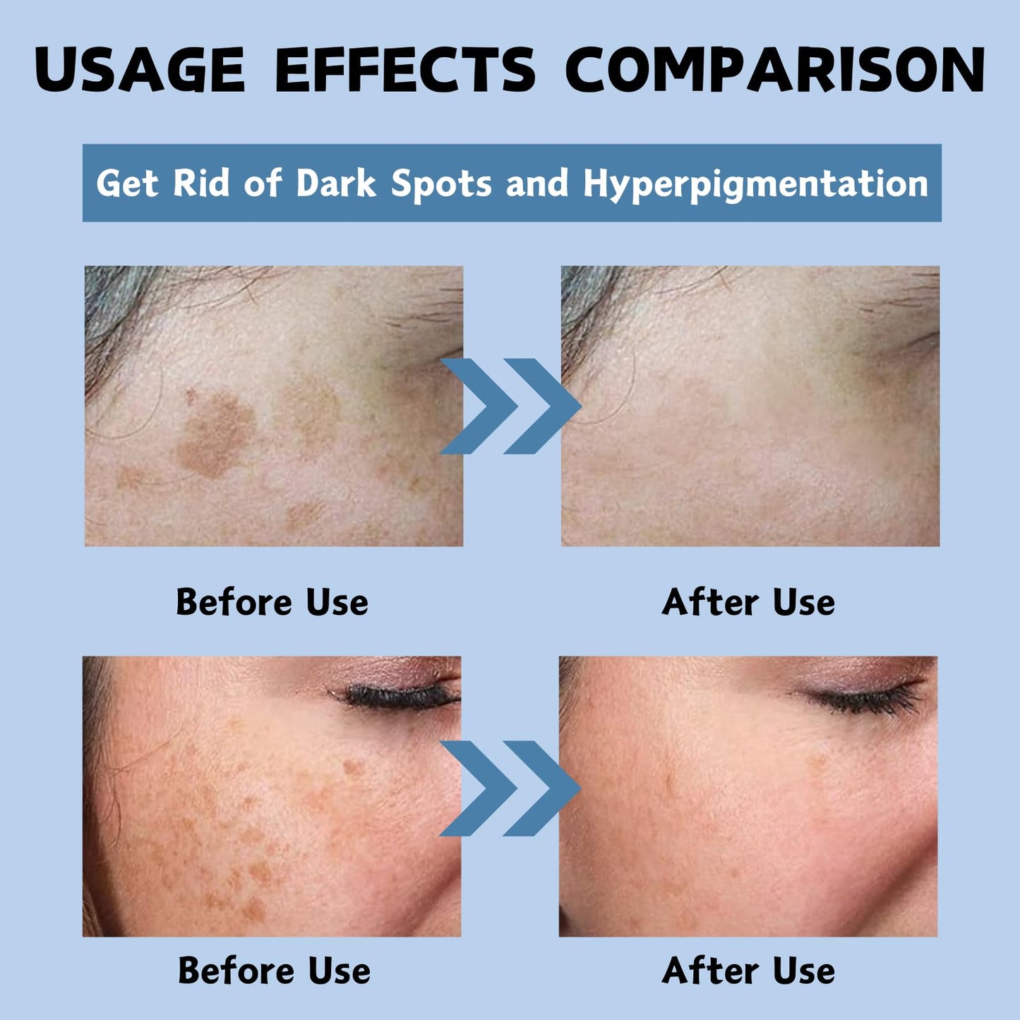 Dark Spot Cream, Tranexamic Acid & Niacinamide Face Cream for Women, Anti Aging Face Cream for Freckles & Hyperpigmentation, Dark Spot Remover for Even Skin Tone, Moisturiser Face Women & Men, 50ml