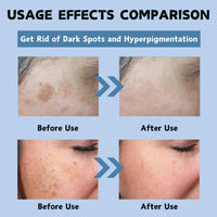 Dark Spot Cream, Tranexamic Acid & Niacinamide Face Cream for Women, Anti Aging Face Cream for Freckles & Hyperpigmentation, Dark Spot Remover for Even Skin Tone, Moisturiser Face Women & Men, 50ml