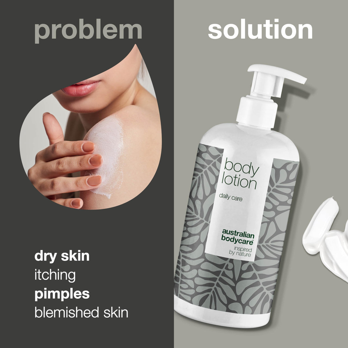 Australian Bodycare Moisturizing Body Lotion with 4-Terpineol, Known from Tea Tree Oil – Relieves Dryness, Itching, and Irritation | Perfect for Acne-Prone Skin