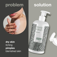 Australian Bodycare Moisturizing Body Lotion with 4-Terpineol, Known from Tea Tree Oil – Relieves Dryness, Itching, and Irritation | Perfect for Acne-Prone Skin