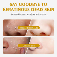 Lemon Exfoliating Gel,Lemon Peeling Gel,Vitamin C Face Scrub,Soft your Skin & Remove Dead Skin,Natural Face Scrub Exfoliator for Blackhead,Mild Face Exfoliator Scrub for Radiant Skin,Face & Body &Knee