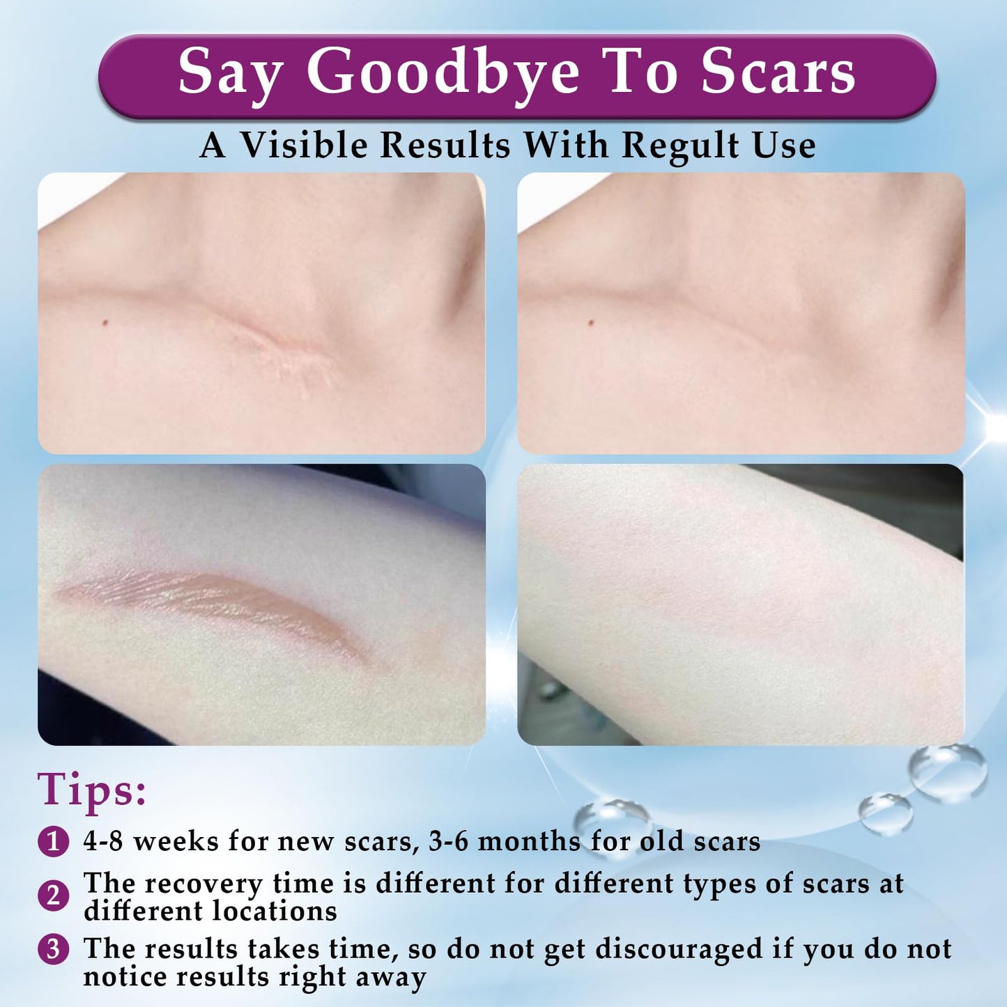 Eveellyn Scar Cream, Scar Gel, Professional Scar Removal Cream for Surgical Scars, Stretch Mark, Keloid Bump, C-Section, Burn, Acne, Old and New Scars 1.7 oz (50g)