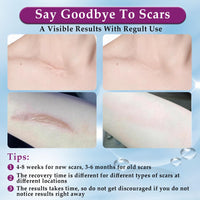 Eveellyn Scar Cream, Scar Gel, Professional Scar Removal Cream for Surgical Scars, Stretch Mark, Keloid Bump, C-Section, Burn, Acne, Old and New Scars 1.7 oz (50g)