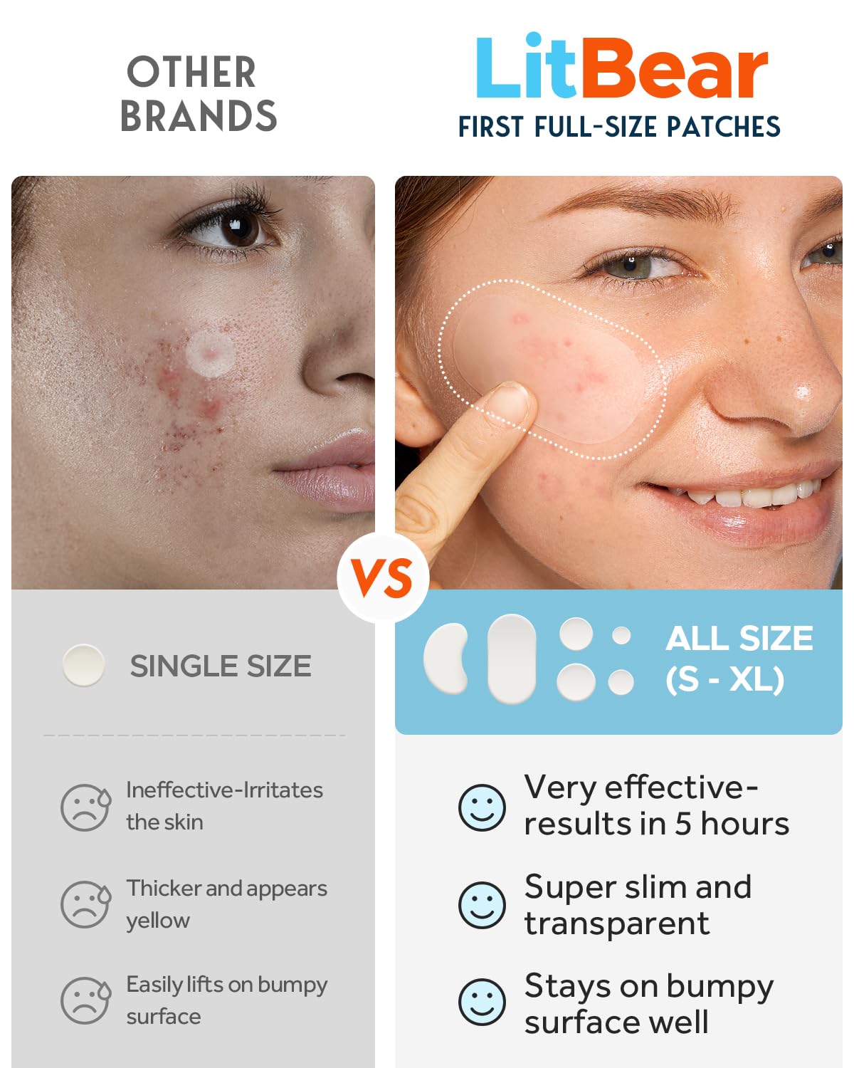 LitBear Pimple Patches, Large Acne Patches for Face, Chin, or Body, Acne Spot with Tea Tree & Calendula Oil, Hydrocolloid Bandages for Acne Skin (100 Patches)