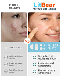 LitBear Pimple Patches, Large Acne Patches for Face, Chin, or Body, Acne Spot with Tea Tree & Calendula Oil, Hydrocolloid Bandages for Acne Skin (100 Patches)