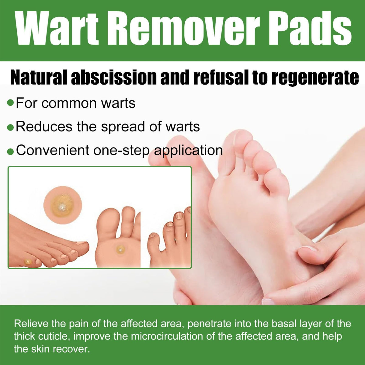 ChunBin 30PCS Verruca Treatment,Wart Treatment Patch,Wart Remover,Plantar Wart Remover for Hands,Pain Free Plasters for Adults,Stops Wart Regrowth,Repair Skin,Easy to Use,Non-Irritating Effective,Pain Relief