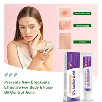 Night Cream Face Moisturiser, Azelaic Acid 12% Facial Serum Cream,Dark Spot Serum Cream for Face,Skincare with Niacinamide & Vitamin C,Beauty Products for Rosacea,Acne,Balance Excess Sebum