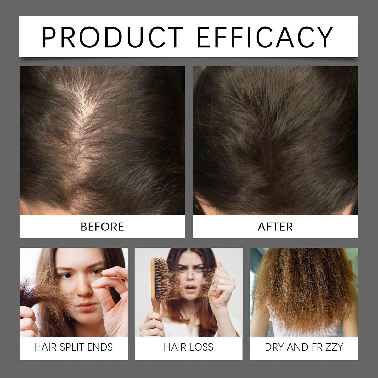 Sugar Gel Hair Growth,H/air Serum for H/air Growth,Sugar Hai/r Growth Serums,Scalp Oil for Hair Growth,Growing Hair Oil Scalp Gel for Hair Strengthening,Hair Thickening Serum,Hair Thinning Treatment