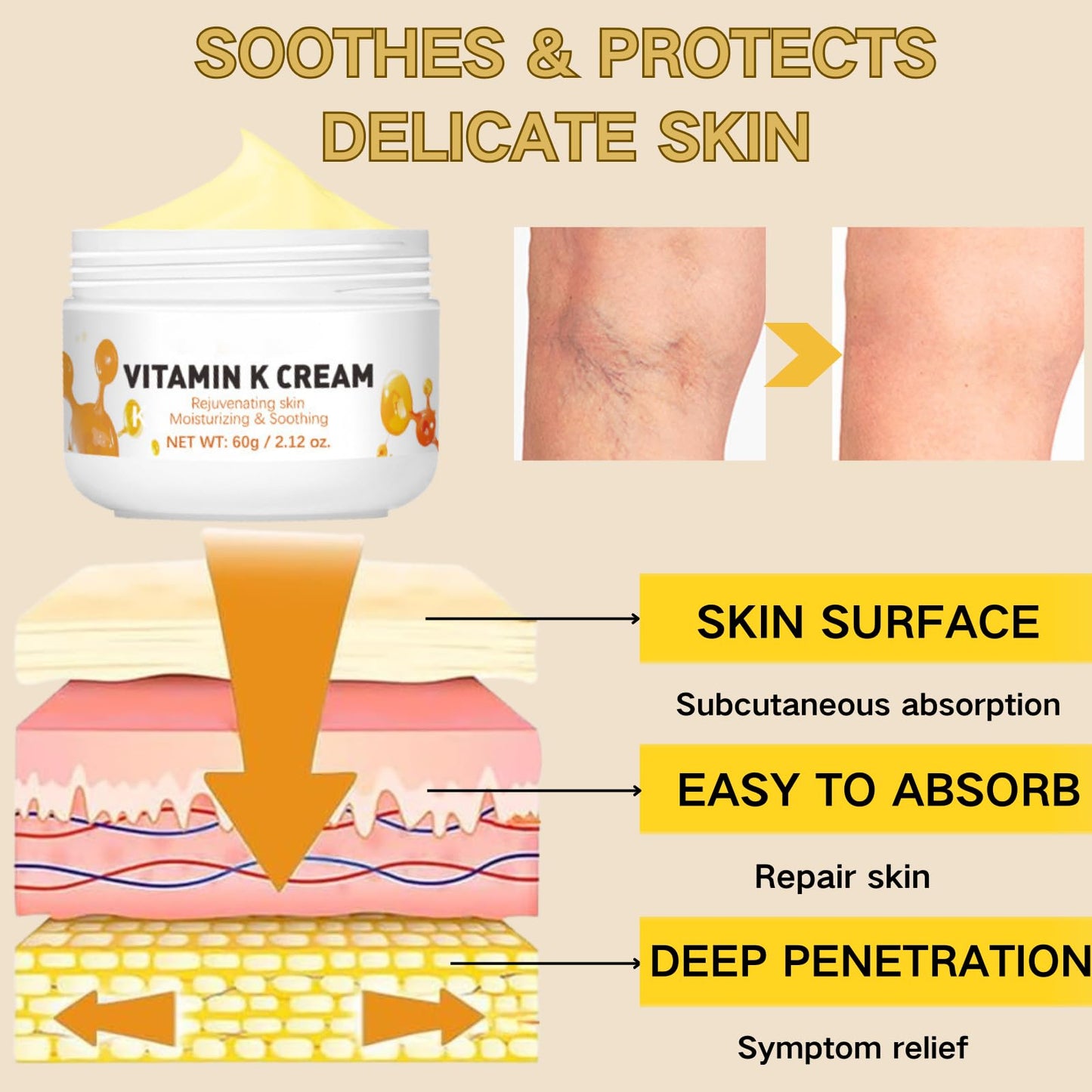 TBeautfave Varicose Veins Cream for Legs & Face - Vitamin Body Cream for Spider Veins & Dark Circles - Skin Repair Cream, Bruise Cream Intensive Moisturizer for Dry Skin, Puffiness, Wrinkles