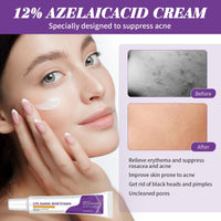 Azelaic Acid Cream,Azelaic Acid Face Cream,Azelaic Acid Serum,Azelaic Acid 12% Facial Serum,Facial Serum Cream,Niacinamide & Vitamin C Face Cream,For All Skin Types (20g)