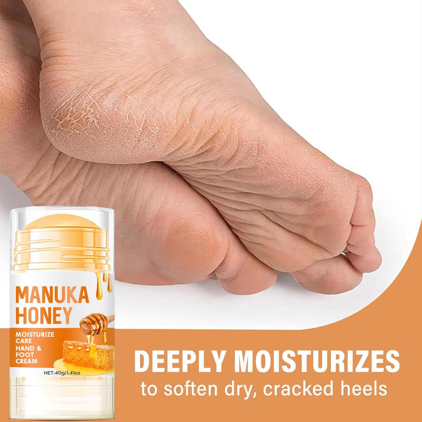 AuraBeen 60% Urea Foot Cream for Dry Skin, Intensive Moisturizing Foot Cream, Improving Heel Repair Ointment for Heels, Feet & Hands