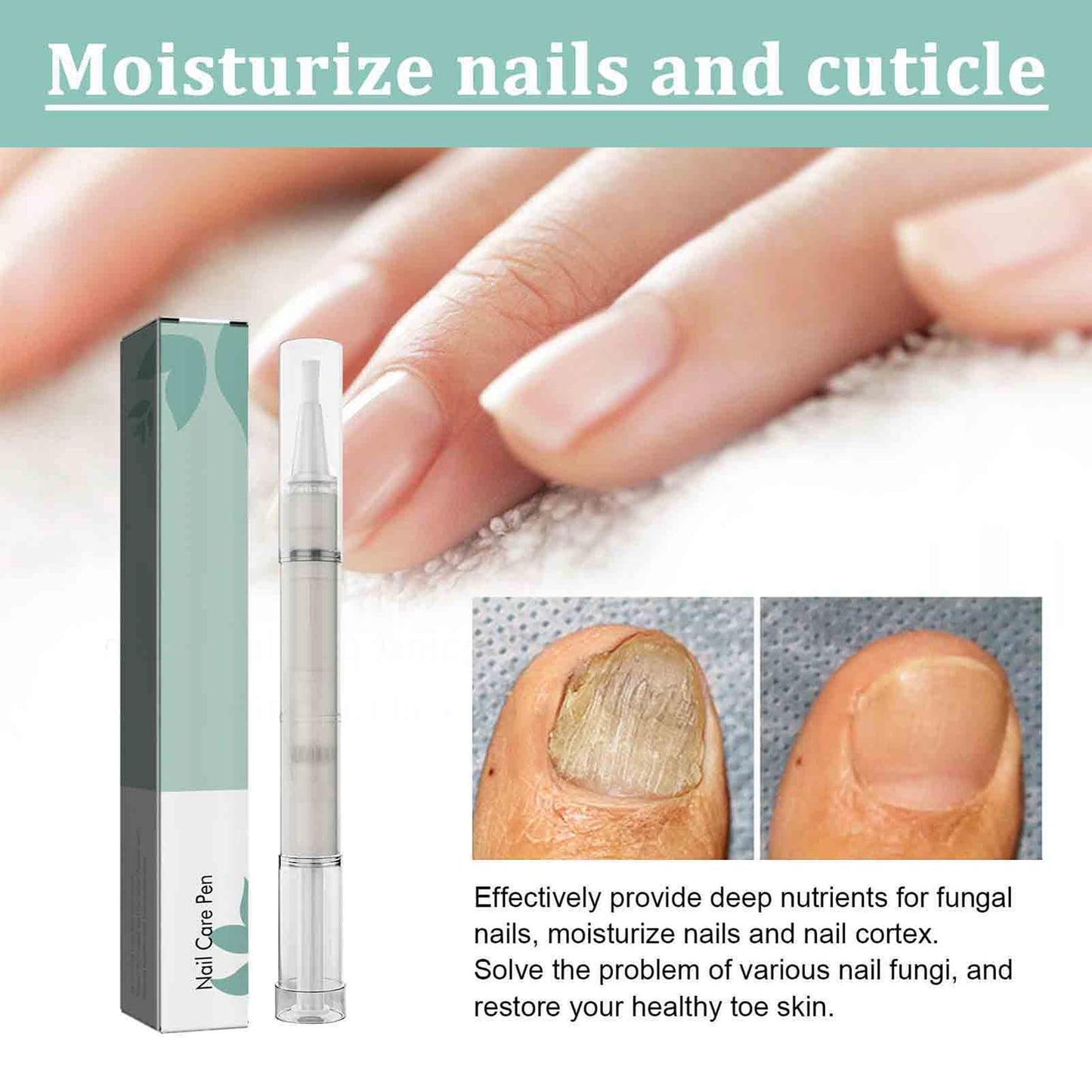 Nail Care Pens, 5Pcs Fungal Nail Treatment Pens, Fungal Nail Treatment for Toenails, Nail Repair Pen, Natural Ingredients Nail Serum for Strengthener Nail