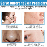 DMQ Repair Face Cream,Smoothing Day Cream,Anti Redness Moisturiser Cream,Firming Face Cream For Sensitive Skin,Face Moisturizer For Women & Men,Vitamin B5 Cream For Acne,Brightening & Repair Damage Skin