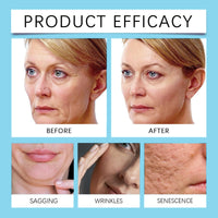 160PCS Anti Wrinkle Patches,Forehead Wrinkle Patches,Wh/ole Face Wrinkle Smoothing Patches,Facial Patches to Reduce Wrinkles for Women,Face & Forehead Wrinkle Patches,Wrinkles Facial Patches