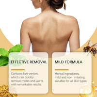 YXtecd TLOPA Bee Venom Skin Treatment Cream, Powerful All-Body Skin Treatment Cream