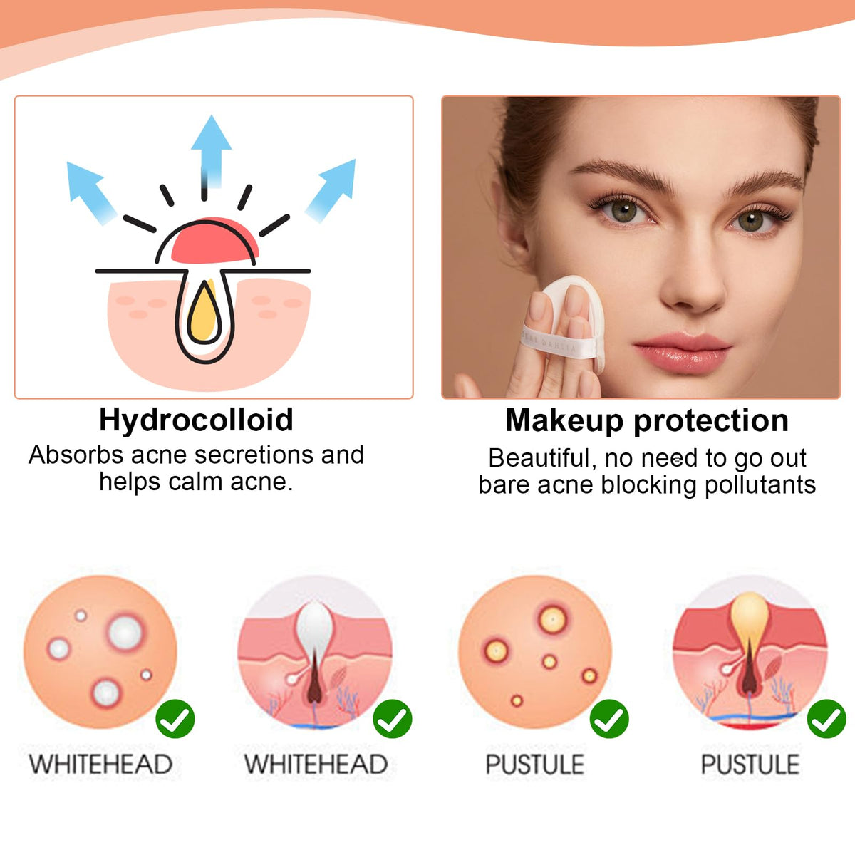 SELURK 32Pcs Hydrocolloid Pimple Patches, Cute Star Shaped Acne Zit Covers, Hydrocolloid Pads for Spot Treatment, Absorb Fluid & Reduce Redness, Gentle for Face and Skin