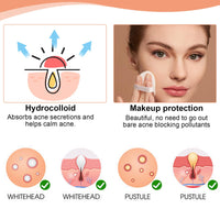 SELURK 32Pcs Hydrocolloid Pimple Patches, Cute Star Shaped Acne Zit Covers, Hydrocolloid Pads for Spot Treatment, Absorb Fluid & Reduce Redness, Gentle for Face and Skin