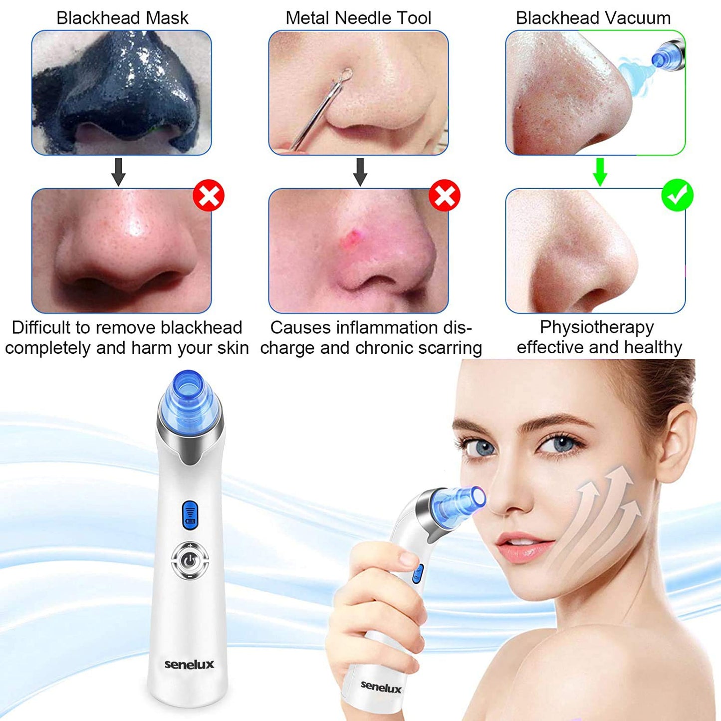 Senua Senelux Blackhead Remover Vacuum Pore Cleaner Acne Comedone Extractor Face Pore Vacuum Blackhead Remover Tool Facial Pore Cleanser with 5 Adjustable Suction Power and 4 Replacement Probes - Blue