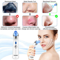 Senua Senelux Blackhead Remover Vacuum Pore Cleaner Acne Comedone Extractor Face Pore Vacuum Blackhead Remover Tool Facial Pore Cleanser with 5 Adjustable Suction Power and 4 Replacement Probes - Blue