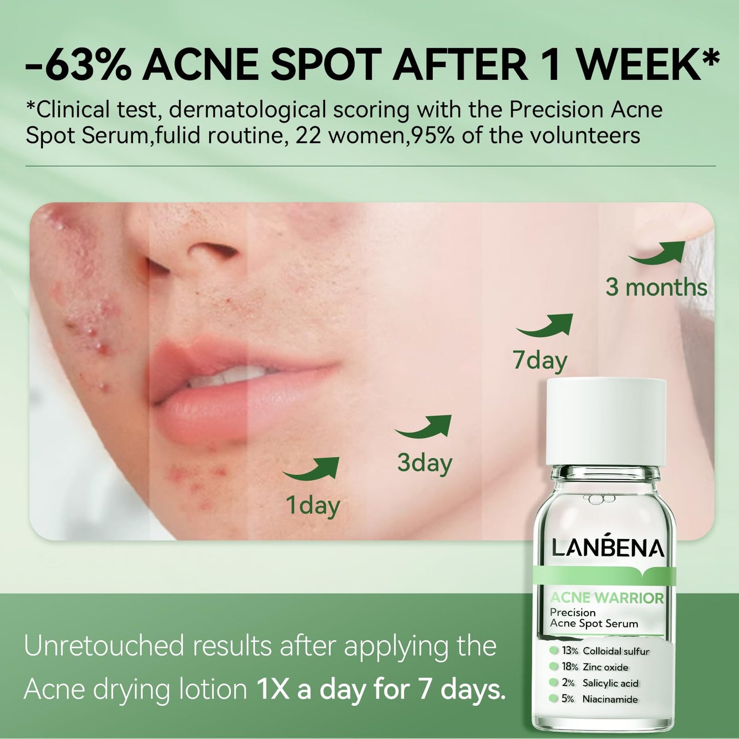 LANBENA Precision Acne Spot Serum, Acne Drying Lotion, Overnight Acne Treatment For Face, Dry Out Pimples, Blemishes, Zits And Clean Pores, 0.42 Fl Oz (Pack of 1)