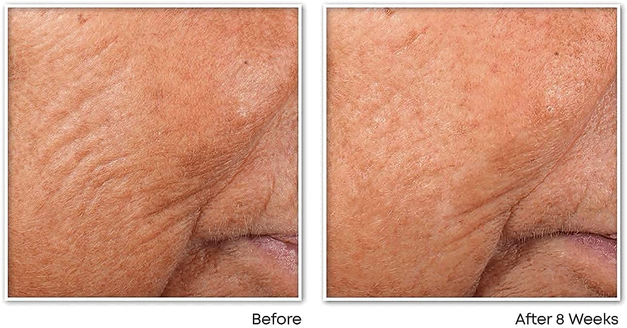 RoC - Retinol Correxion Line Smoothing Night Serum Capsules - Daily Anti-Aging Skin Care Treatment - Firming Moisturiser - 30-Piece