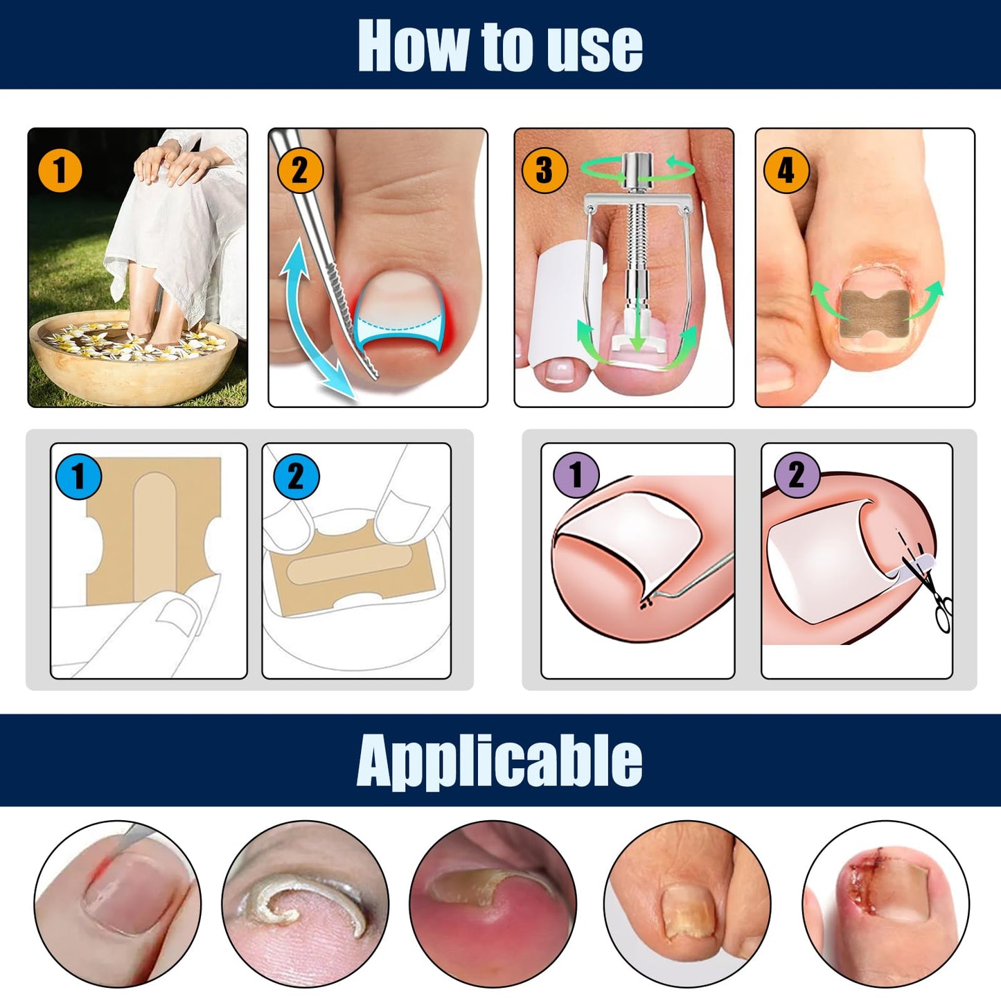BQMEZRNUS Ingrown Toenail Removal Kit Ingrown Toenail Treatment Tool Kit Ingrown Toenail Corrector Tools with Toenail Braces, Podiatry Tools, Ingrown Toenail Corrector Strips and Patch for Toe Pain Relief