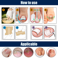 BQMEZRNUS Ingrown Toenail Removal Kit Ingrown Toenail Treatment Tool Kit Ingrown Toenail Corrector Tools with Toenail Braces, Podiatry Tools, Ingrown Toenail Corrector Strips and Patch for Toe Pain Relief