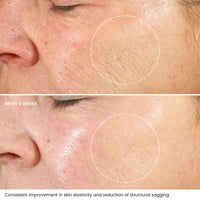 Retinol Face Cream with Hyaluronic Acid & Vitamin E | The Best Anti Aging Cream to Reduce Wrinkles & Age Spots | Day & Night use | for Women