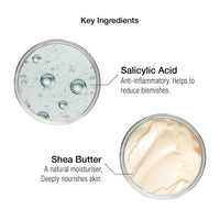 Super Facialist Salicylic Acid Anti Blemish Purify & Refresh Face Scrub - Face Wash for Acne Treatment & Blackhead Remover with Salicylic Acid & Vitamin B 3, Vegan Friendly, 150ml