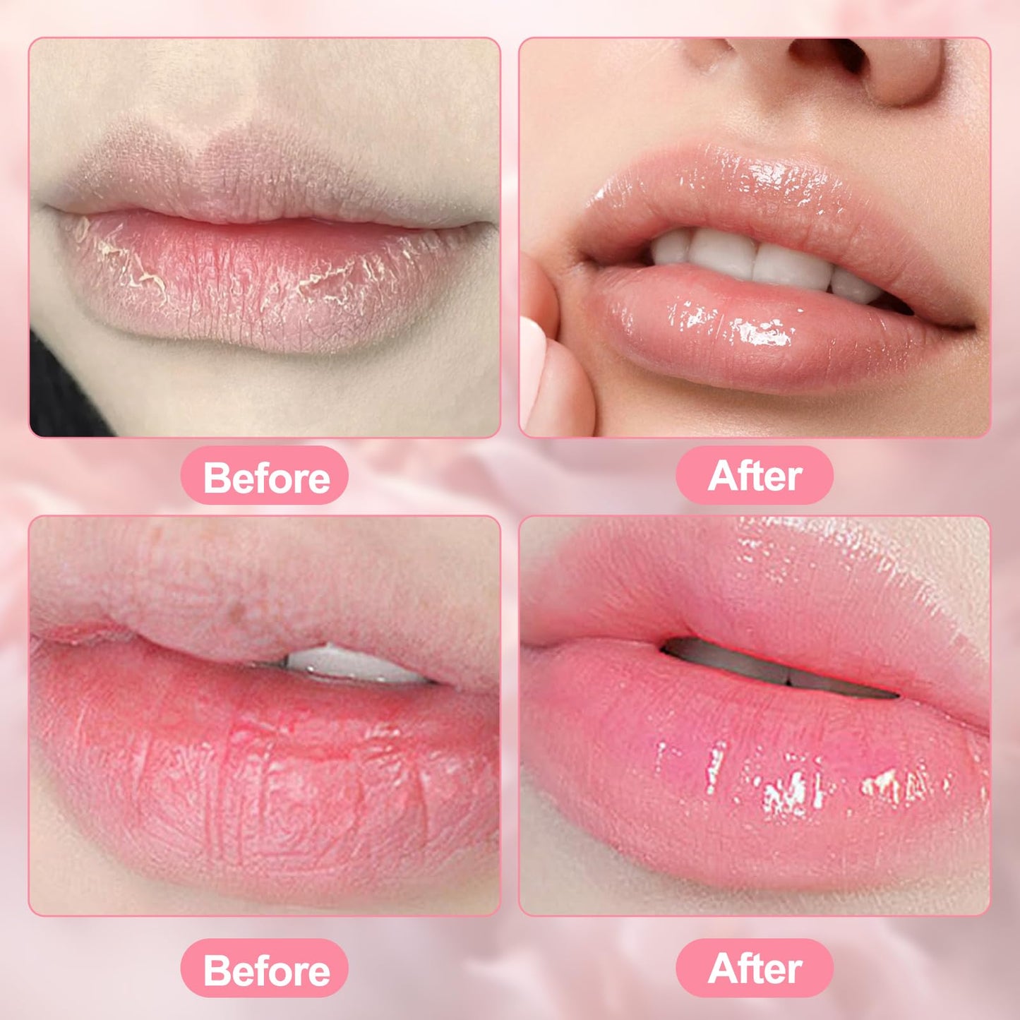 Anmahe 3Pcs Bee Lip Balm Honey Pot with Stick, Lip Mask Day And Night Repair and Care, Moisturizing Lip Sleeping Cream, Silky Hydrate Repair Prevent Dry Cracked Lip Exfoliator(Honey+Strawberry+Watermelon)