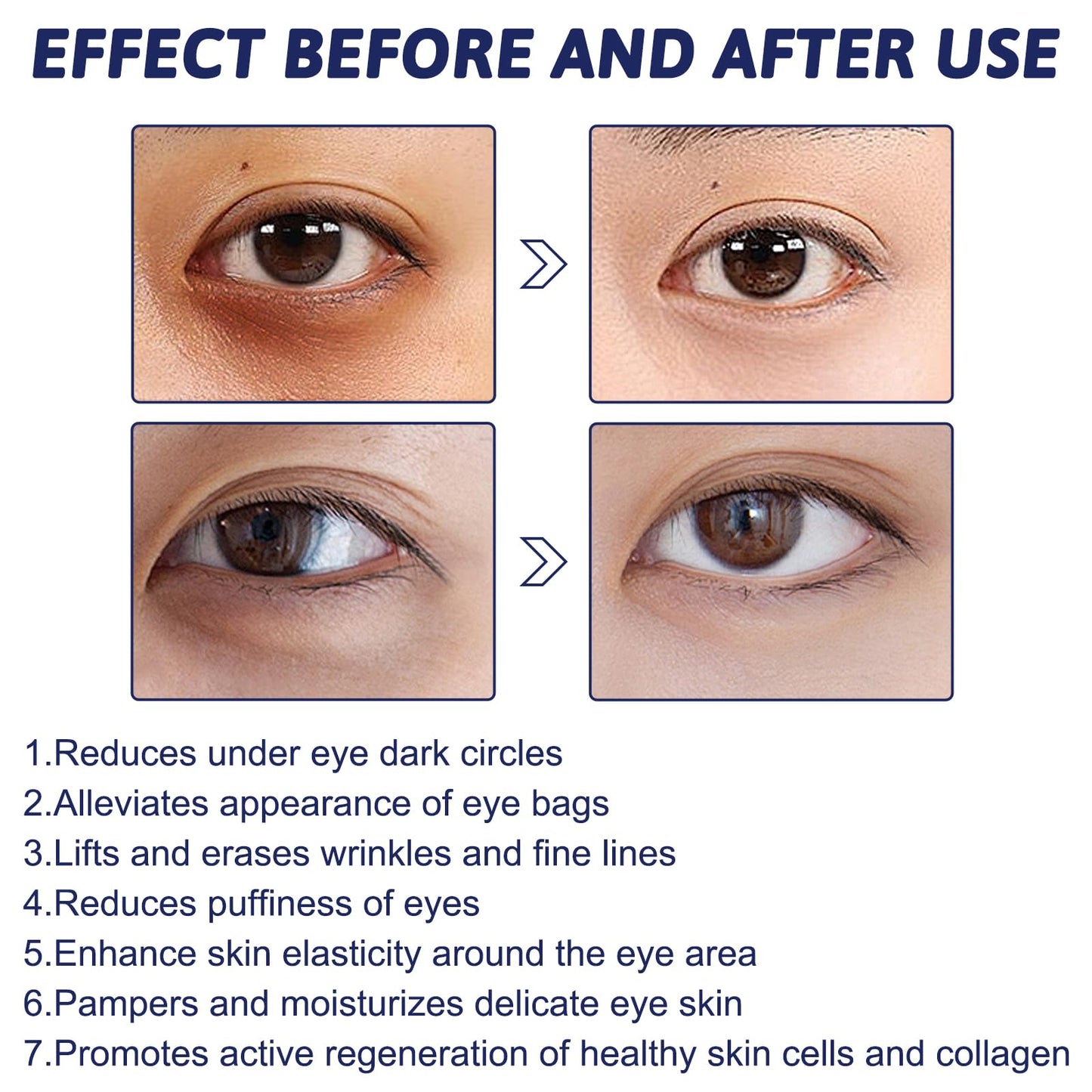 LINXINS Seagrill Serum Anti Wrinkle Essence, Instant Firm Eye Bag Cream, Eye Tightening Cream Instant for Eliminate Wrinkles, Eye bags, Puffiness, and Tightens the Skin Around the Eyes (60ml)