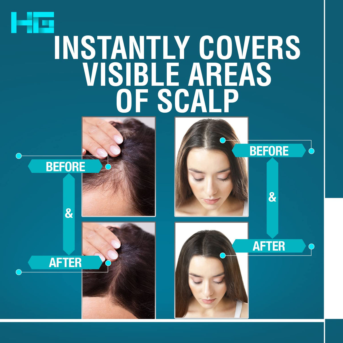 Hair Genetics Root Cover Up Dark Brown, Hide Your Grey Roots and Bald Spots Quickly and Easily, Natural Looking Root Touch Up Powder Defines and Fills in Eyebrows (Dark Brown)…