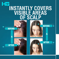 Hair Genetics Root Cover Up Dark Brown, Hide Your Grey Roots and Bald Spots Quickly and Easily, Natural Looking Root Touch Up Powder Defines and Fills in Eyebrows (Dark Brown)…