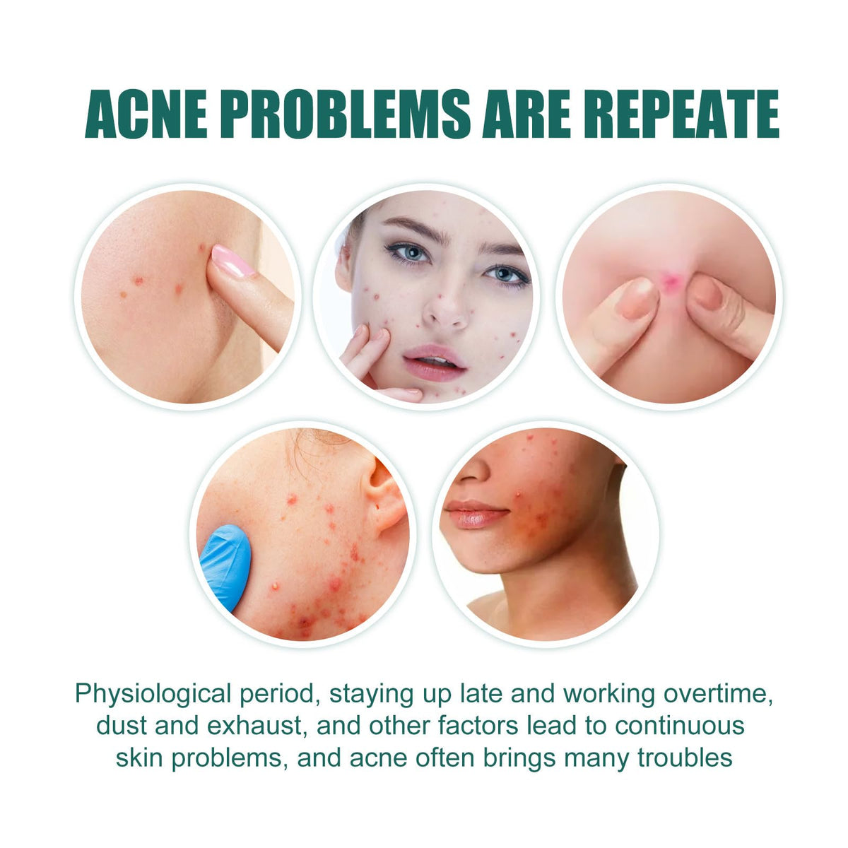 LIDOUK 12mm and 8mm spot patches, acne patches, star shaped, water-based gel patches for acne, blemishes, cyanosis, and facial acne patches (112 patches)
