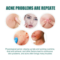 LIDOUK 12mm and 8mm spot patches, acne patches, star shaped, water-based gel patches for acne, blemishes, cyanosis, and facial acne patches (112 patches)