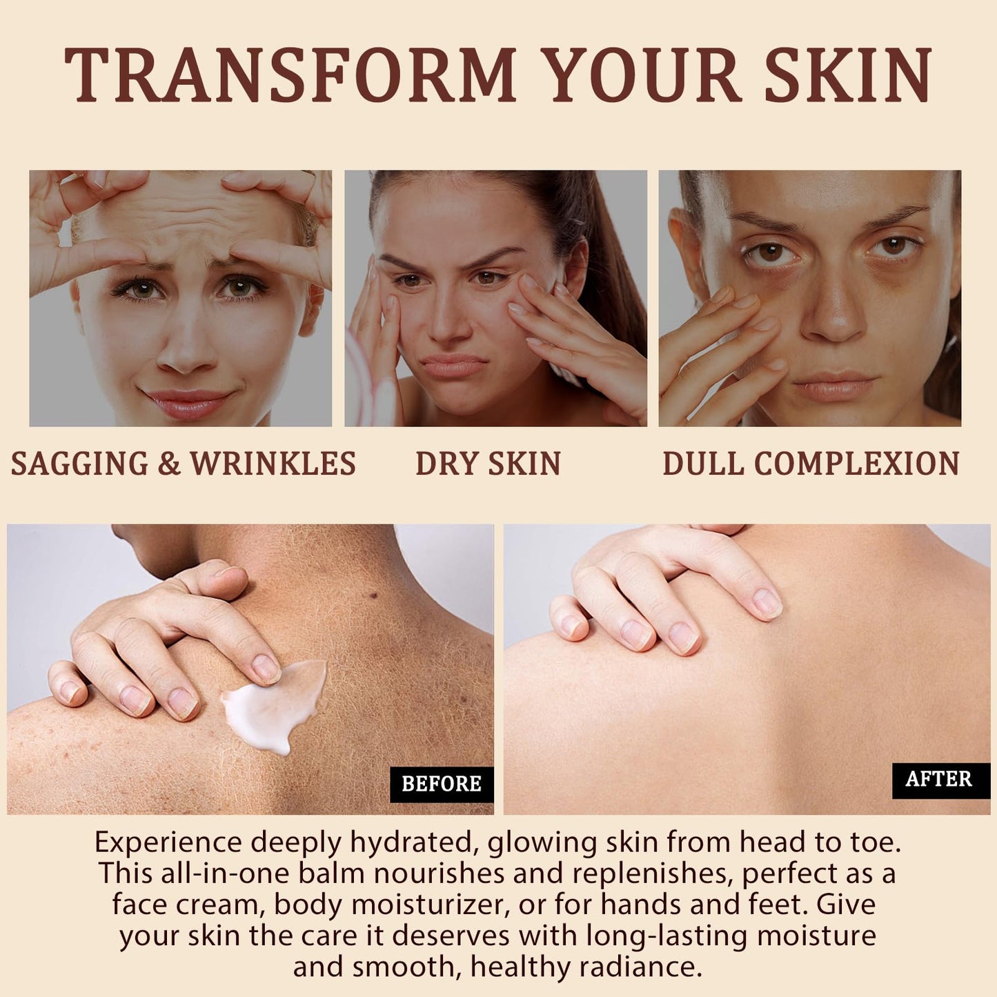 NIFEISHI Whipped Beef Tallow Skin Care, Tallow Face Cream, Grass Fed Beef Tallow and Honey Balm, Organic & Natural Moisturiser Deeply Nourish Face & Body for Women and Men, 120g/4.2 oz