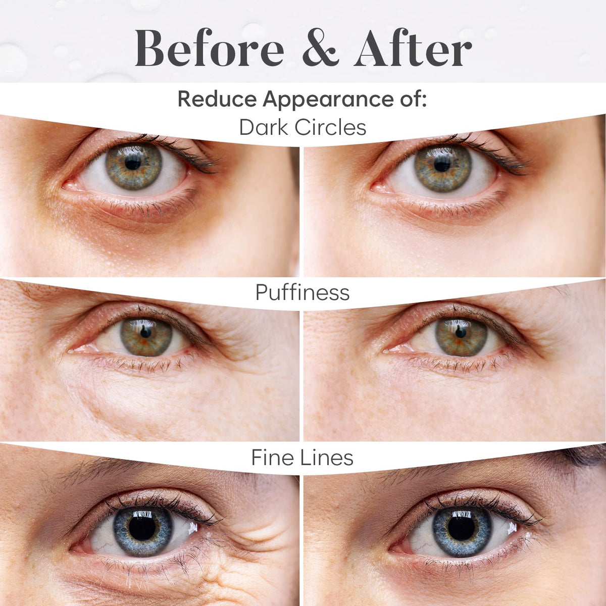BLOOMORA Variety Under Eye Gel Patches (30 Pairs) | Eye Masks for Puffy Eyes | Collagen Eye Patches | Under Eye Patches for Dark Circles & Puffiness | Under Eye Mask for Eye Care