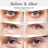 BLOOMORA Variety Box Under Eye Gel Patches (30 PAIRS), Under Eye Patches for Puffy Eyes & Dark Circles, Hyaluronic Acid + Collagen Gel Pads for Reducing Appearance of Puffiness & Increased Hydration