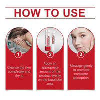 20g Whitening Freckle Cream,Spot Removal Treatment Cream,Dark Spots Removal cream for Face,Sp/ot Off Freckle Whitening Cr/eam,Frec/kle Remover Crea/m,Anti Blemish Face cre/am