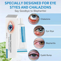 Orknglowy 2PCS Chalazion & Blepharitis Treatment Eye Cream, Chalazion Eye Treatment, Eyelid Cream for Blepharitis, Stye Treatment for Dry Eyes, Moisturizing Eyelid Cream for Daily Eye Care, Soothe, Hydrate