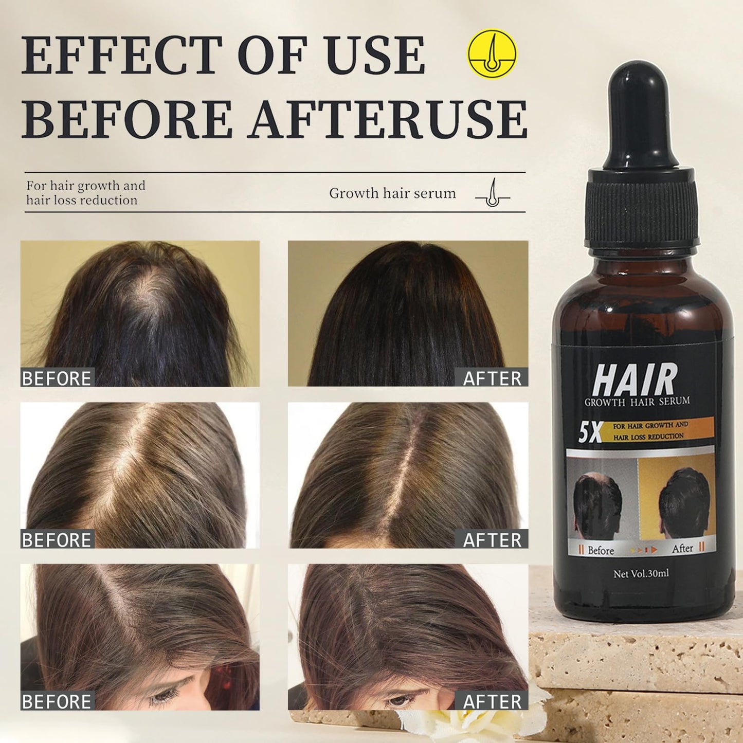 Hair Growth Serum Anti Hair Loss Hair Oil, Organic Natural Hair Loss Treatment for Thin Dry Hair, Nursing Scalp, Promote Natural Hair Growth, Regrowth Hair Serum for Men and Women