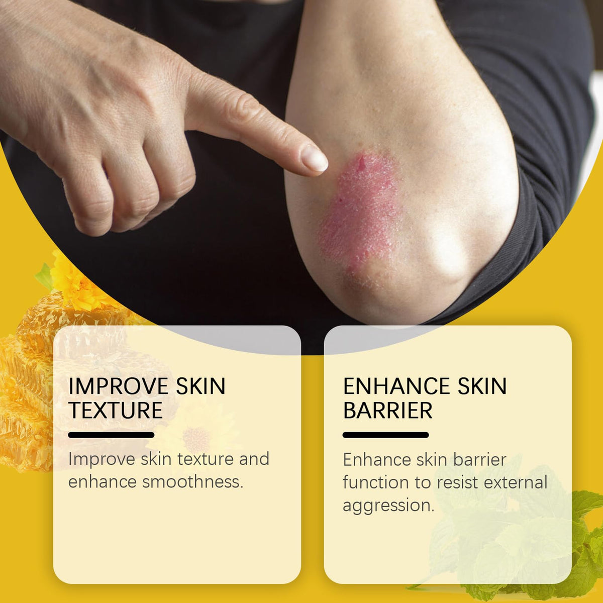 ISBEAUSOLS Bee Venom Cream - Anti-Ageing Day & Night Cream for Wrinkles - Firming Creams for Menopause Skin Tightening - Bee Venom Skin Treatment Creams - Honey & Dry Elbow Repair - Bumpy Skin Relief