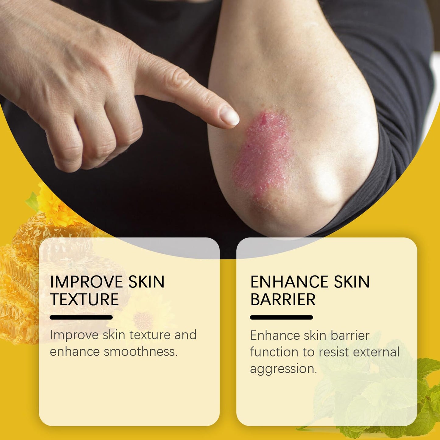 ISBEAUSOLS Bee Venom Cream - Anti-Ageing Day & Night Cream for Wrinkles - Firming Creams for Menopause Skin Tightening - Bee Venom Skin Treatment Creams - Honey & Dry Elbow Repair - Bumpy Skin Relief