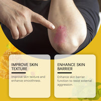 ISBEAUSOLS Bee Venom Cream - Anti-Ageing Day & Night Cream for Wrinkles - Firming Creams for Menopause Skin Tightening - Bee Venom Skin Treatment Creams - Honey & Dry Elbow Repair - Bumpy Skin Relief