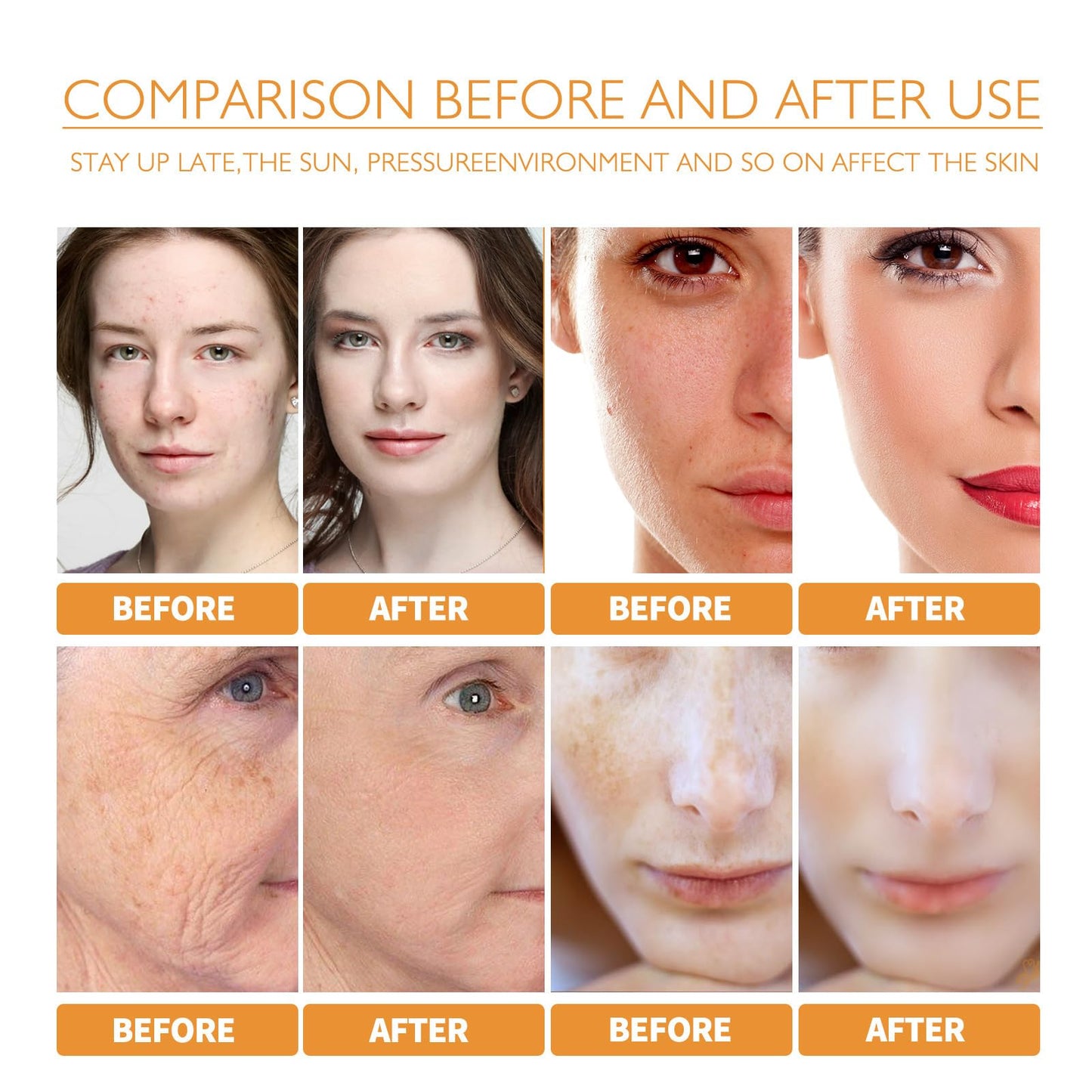 Kojic Acid Turmeric Oil - Dark Spot Remover for Face - Turmeric Oil Dark Spot Corrector - Kojic Acid Remove Facial Melasma Acne - Anti Aging Face Serum Moisturzing (1PCS)