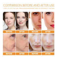 OKAQEE Kojic Acid Turmeric Oil - Dark Spot Remover for Face - Turmeric Oil Dark Spot Corrector - Kojic Acid Remove Facial Melasma Acne - Anti Aging Face Serum Moisturzing (1PCS)