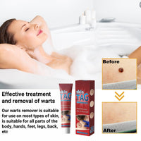 Jinjiar Wart Remover Cream,Effective Wart Removal,Mole Remover,Fast Effective Safe Skin Mole Removal,Wart Treatment for Face & Hands & Body,Wart Remover for Hands,Wart Re-Mover for Face,Flat Wa-rt Remover