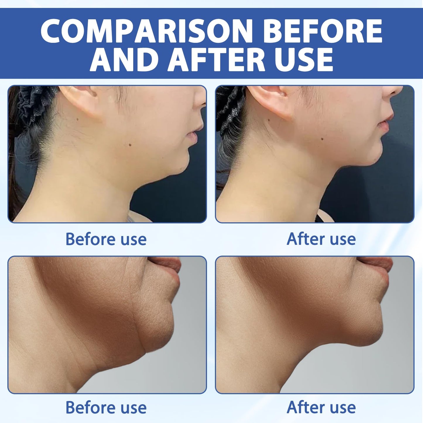 GMHLLES 3 Pieces Chinology Double Chin Lifting Mask, Chin Lift Mask, Moisturizes and Tightens the Skin, the Texture Is Light and Fits the Skin, and Changes the Jawline